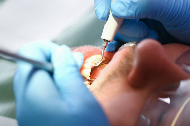 Best Cosmetic Emergency Dentistry in South Corning, NY